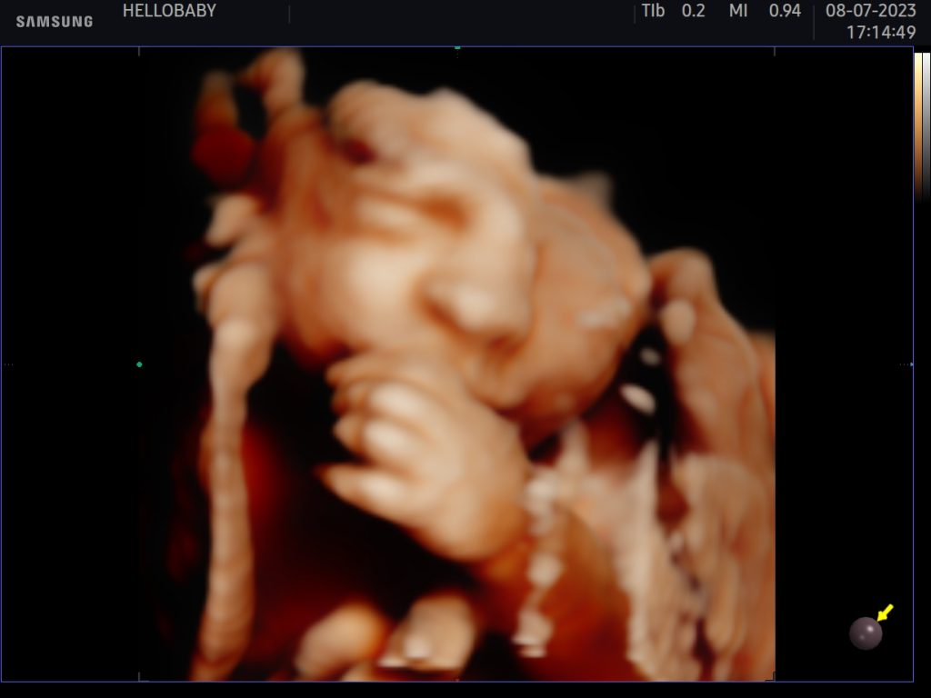 regalo original para una embarazada